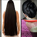 Stop Hair Fall, Get long Thick Black Hair Fast Naturally