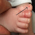 BAGI KALIAN SEMUA PARA ORANGTUA BERHATI-HATILAH..!!! JIKA ANDA MENEMUKAN TANDA SEPERTI INI DI JARI KAKI BAYI ANDA SEGERA PERIKSAKAN KEDOKTER..!! JIKA TIDAK INGIN KEHILANGAN NYAWA BAYI ANDA!!! BERITAHU IBU DAN ORANGTUA YANG LAINNYA!!