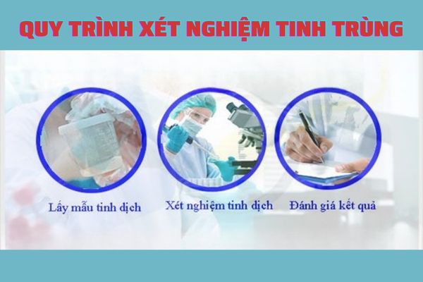 Quy trình xét nghiệm tinh trùng tại huyện Nam Đàn