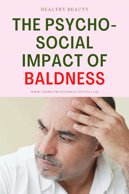 The Psycho-social Impact of Baldness
