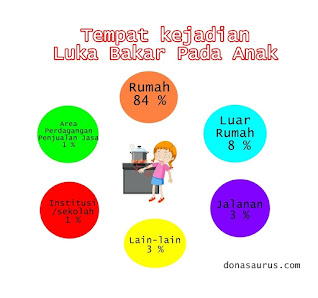 luka bakar pada anak