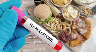 Obat Kolesterol Herbal Alami Paten Langsung Turun 