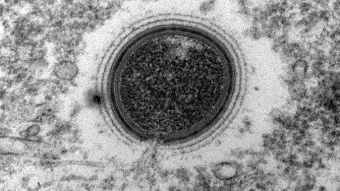 Ngeri, Sebuah Virus Bangkit Setelah Tidur Selama 30.000 Tahun