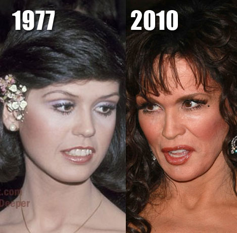 Marie Osmond before and after