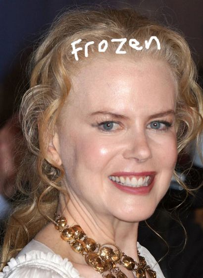 nicole kidman plastic surgeries