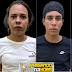 Fugitivo em perseguição policial atropela e mata pai e filha (veja o vídeo)