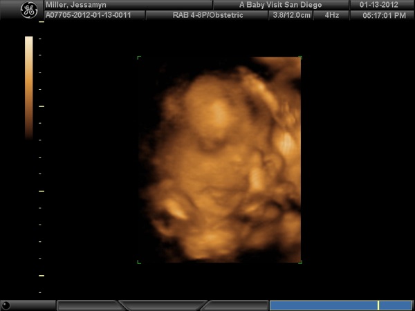 BABY_17.JPG BABY 17