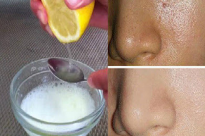 Just By Using 2 Ingredients Your Pores Will Disappear Forever And Your Face Will Be Cleaner Than Ever!