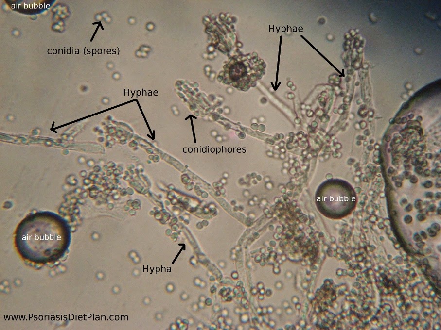 In this picture you can see the whole structure of fungus with spores 