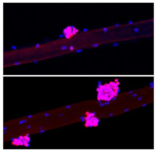 Una comparación entre un grupo de control (arriba) y el grupo experimental (abajo), que recibió factores de Yamanaka en la fibra muscular. Las manchas rosadas representan un marcador de células madre musculares llamado Pax7