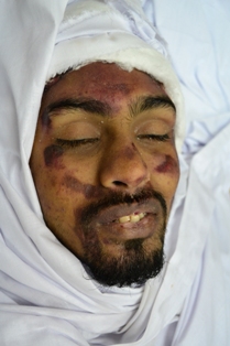 Abusing Human Rights Bahrain Abusing Human Rights Bahrain