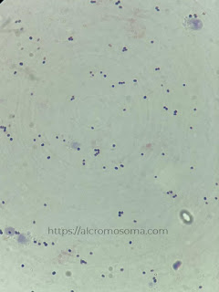 gram positive under microscope