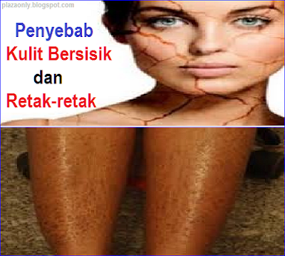 Penyebab Kulit Bersisik dan Retak-retak