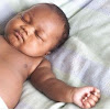 Black Baby Eczema Pictures