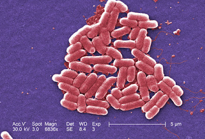 Escherichia coli, salah satu makhluk hidup bersel satu(uniselulet)
