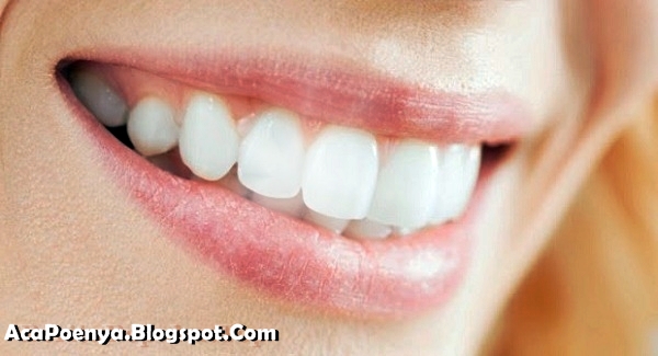 Gigi Putih Bersih