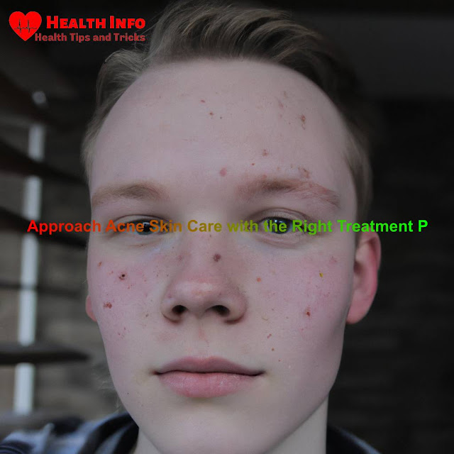 A portrait of an individual suffering from acne