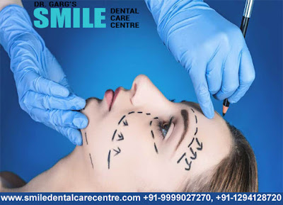 Best Face Surgeon in Faridabad