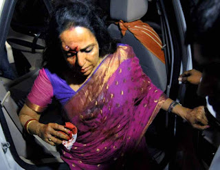 Hema Malini, Hema Malini injured, Hema Malini in hospital, Jaipur, Fortis Hospital Jaipur, Hema Malini accident