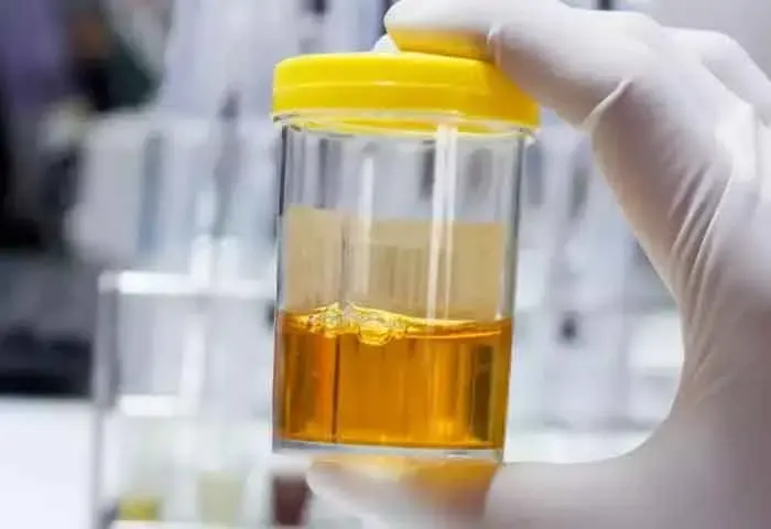 Groundbreaking Study Identifies Enzyme Responsible For The Yellow Colouration of Urine?