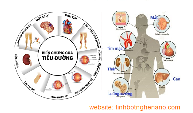 bệnh tiểu đường