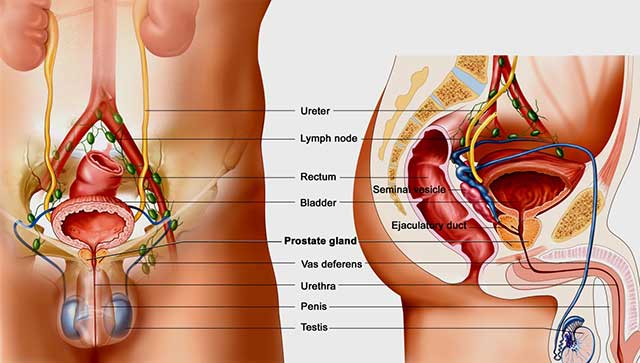 Obat Herbal Kanker Prostat