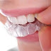 Braces Aren't Just For Kids!Why the Boom in Cosmetic Dentistry?