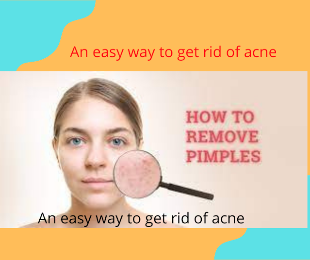 An easy way to get rid of acne