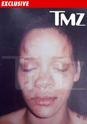 Picture of Rihanna beat up