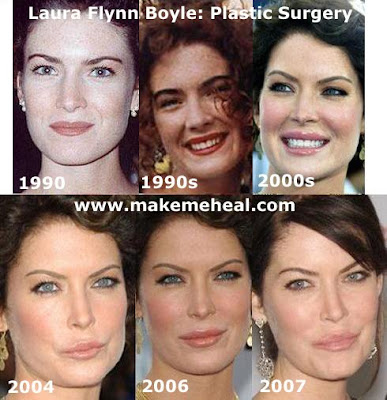 Lara Flynn Boyle