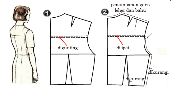 Perbaikan Punggung dan Sisi