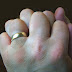 Cracking Your Knuckles Does Not Cause Arthritis