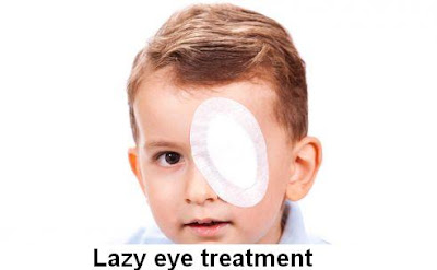 Lazy Eye Causes, Diagnosis And Treatment