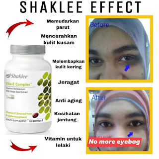 Testimoni Vitamin E Shaklee