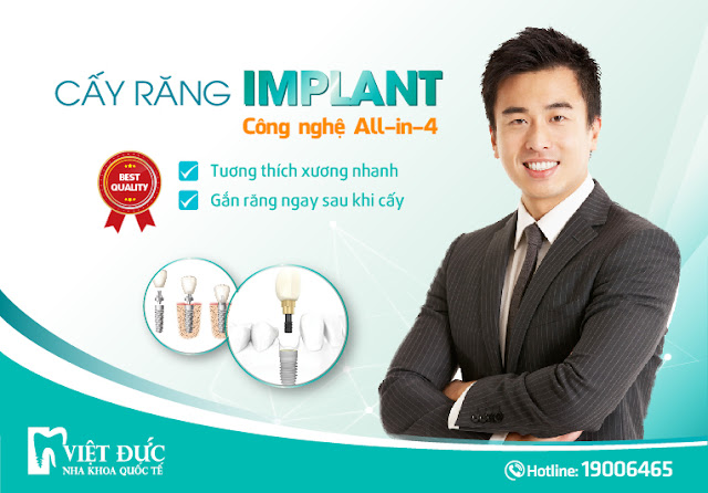 Kỹ thuật trồng răng Implant All-in-4 đang nhận được nhiều phản hồi tích cực từ khách hàng