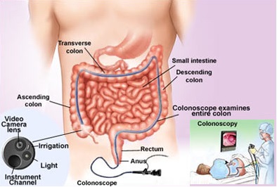 Colorectal Cancer Screening ICD 9 and CPT Codes