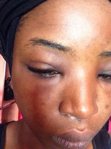 Singer Lady Jay Assaulted By  Manager