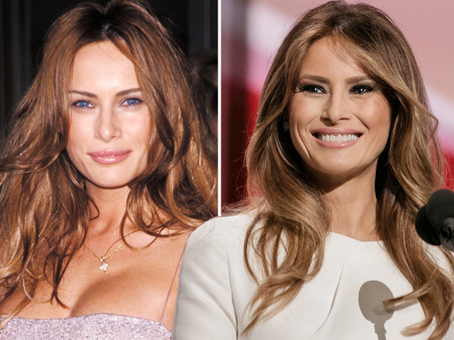 Melania Trump's 10-Year Smile: A Beauty (and Botox) Evolution of the First Lady