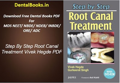 Step By Step Root Canal Treatment Vivek Hegde PDF