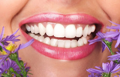  Khuyết điểm răng bị vàng có tẩy trắng được không? 