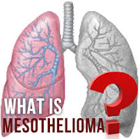 मेसोथेलियोमा कैंसर क्या है। What is Mesothelioma Cancer
