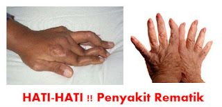 obat rematik ditangan