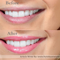 How to Lighten Dark Lips Naturally At Home
