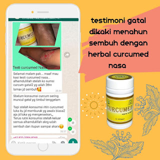 obat herbal gatal gatal seluruh badan