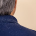 How to Cure Dandruff Permanently Naturally at Home?