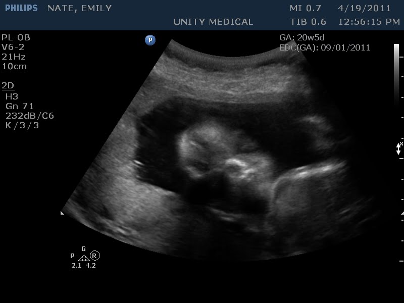 3d ultrasound 20 weeks boy. 20 week ultrasound today.