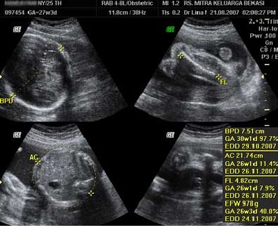 All about Medical Physics USG  Ultrasonography 