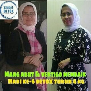 Jual Synergy Smart Detox  di Wilayah Hamparan Perak, Deli Serdang Kontak: 6281319308376