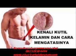 obat kutil kelamin,tanda kutil kelamin,gejala kutil kelamin,ciri ciri kutil kelamin,muncul kutil di sekitar kelamin,obat kutil tanpa operasi,cara menghilagkan kutil kelamin tanpa operasi