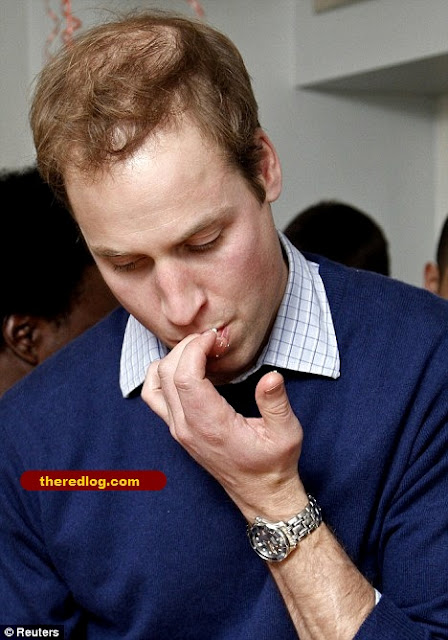 prince william locker room. Bald truth: Prince William